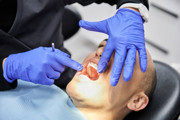 Best Dental Abscess Treatment in Olivet, NJ