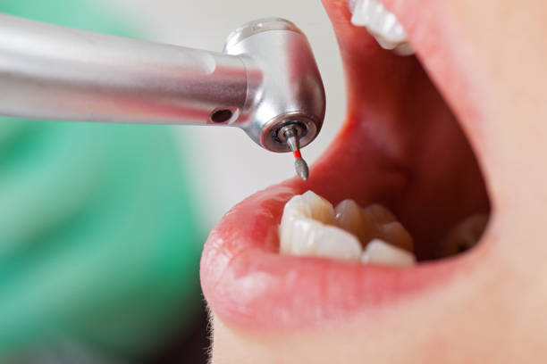 Best Emergency Cosmetic Dentistry (e.g., broken veneers) in Olivet, NJ